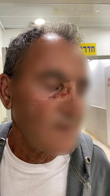 צילום: באדיבות ארגון חוננו